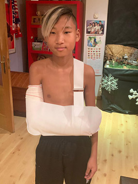 El portero del Infantil B, Chechu, sufrió fractura del cúbito y radio de su brazo derecho.